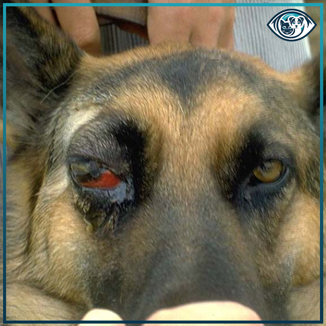 Retrobulbar Tümör Nedir?