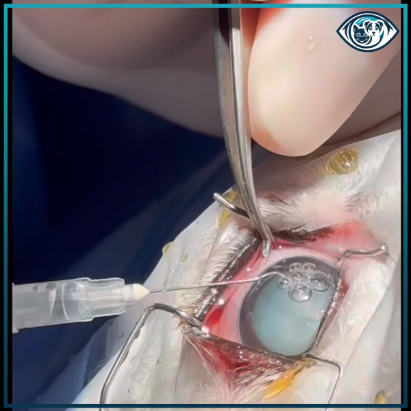 Bilateral Kornea Onarımı Nedir?